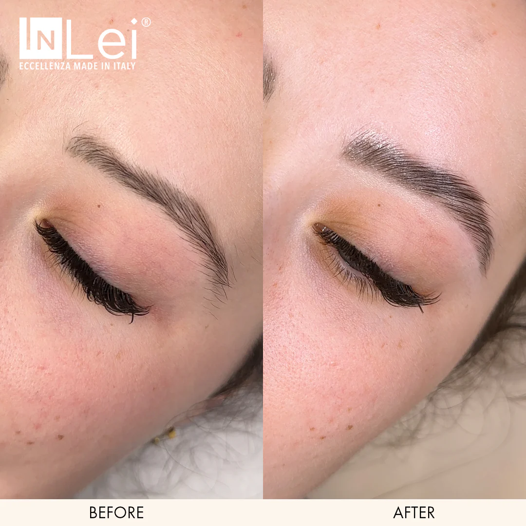 InLei® Brow Lift 1 - Image 4